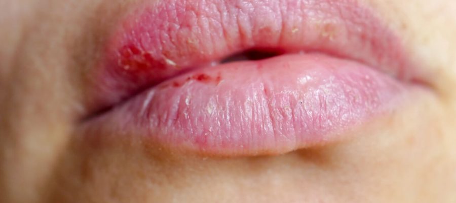 lip injury