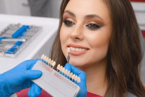 Teeth whitening methods