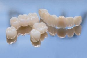 How to Remove Tartar from Dentures Instantly clean